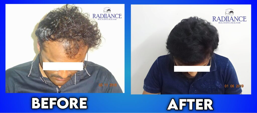 Radiance Hair Transplant Clinic