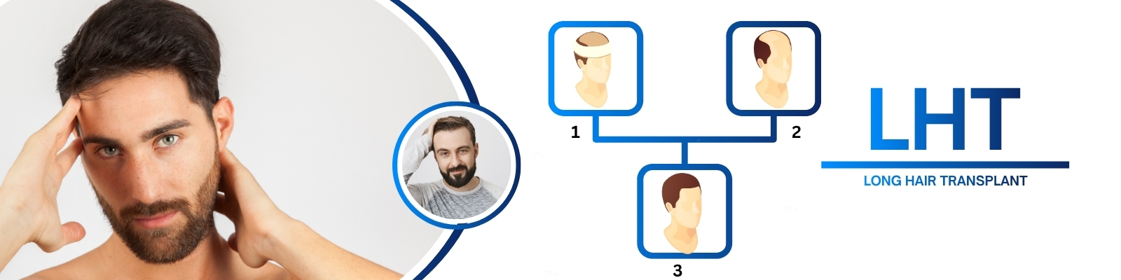 Long hair transplants in rajahmundry