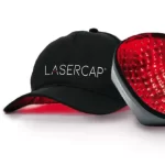 Is Laser Cap Treatment the Best for Hair Loss?