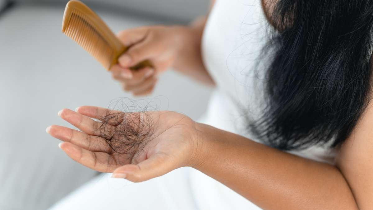 Everything You Need to Know About Hair Loss in Women