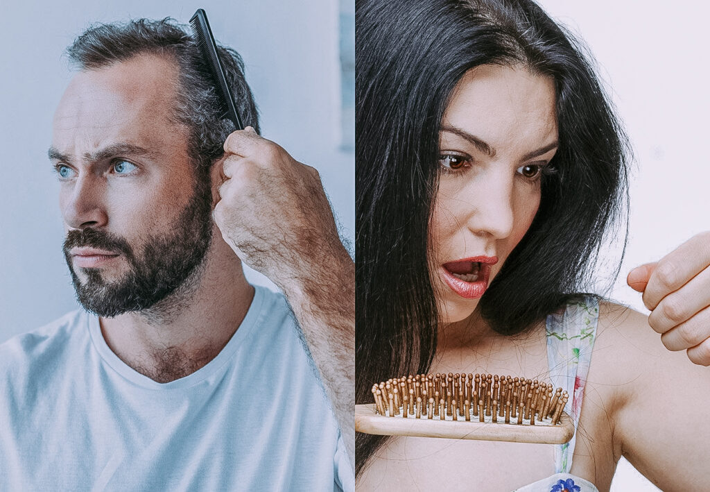 Hair Loss in Men and Women