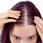 Hair Regrowth center in hyderabad
