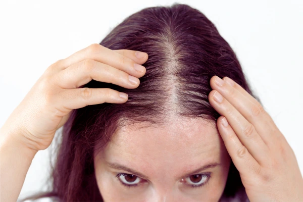 Hair Regrowth center in hyderabad