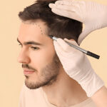 Radiance-Hair-Transplant
