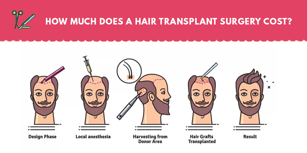 Hair transplant costs per graft Archives - Radiance Hair Transplant