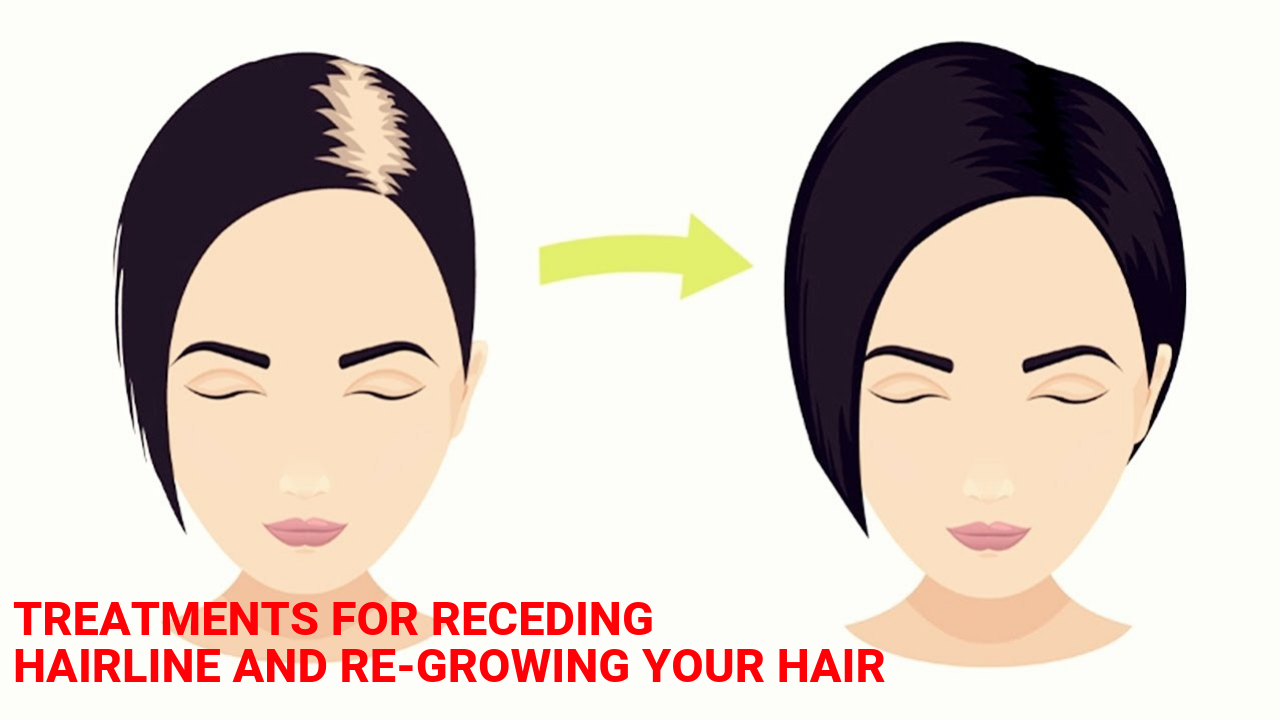Treatments For Receding Hairline And Re-growing Your Hair