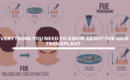 Everything you need to know about FUE Hair Transplant