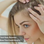 how to stop hair loss